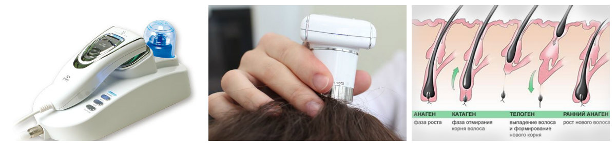 Процедуры для волос: трихоскопия